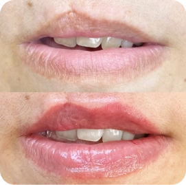 Facetune_11-03-2022-10-26-10 1